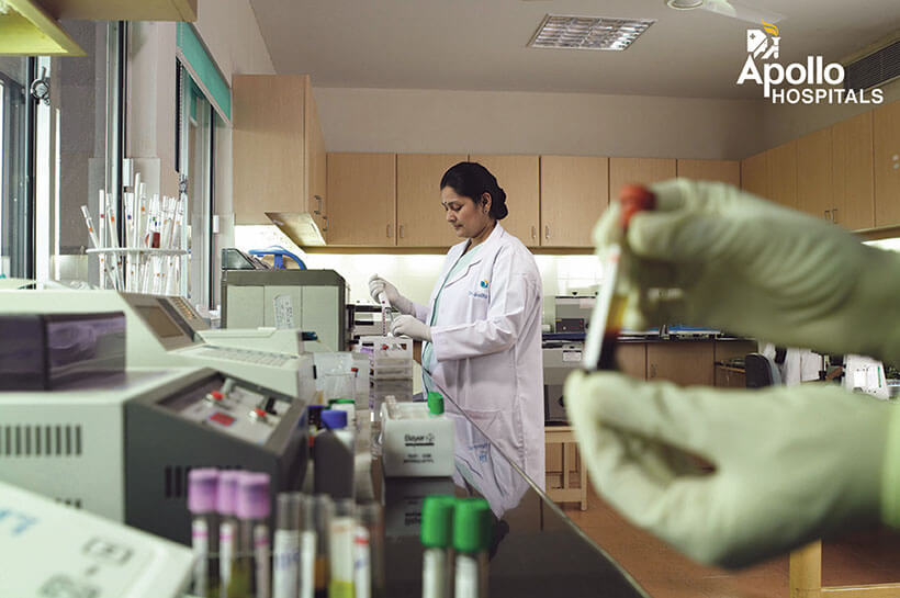 Apollo Diagnostics – Blood Tests